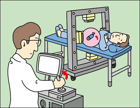 A diagram showing a doctor examining a patient using a self-propelling capsule endoscope