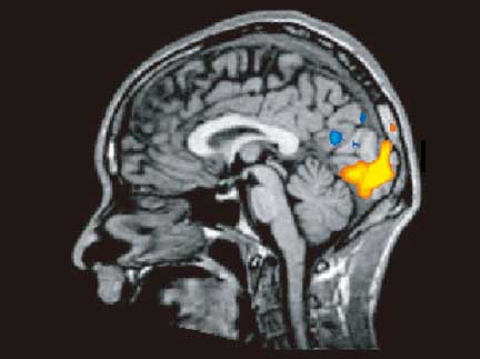 An image from the analysis of blood flow changes. ©ATR